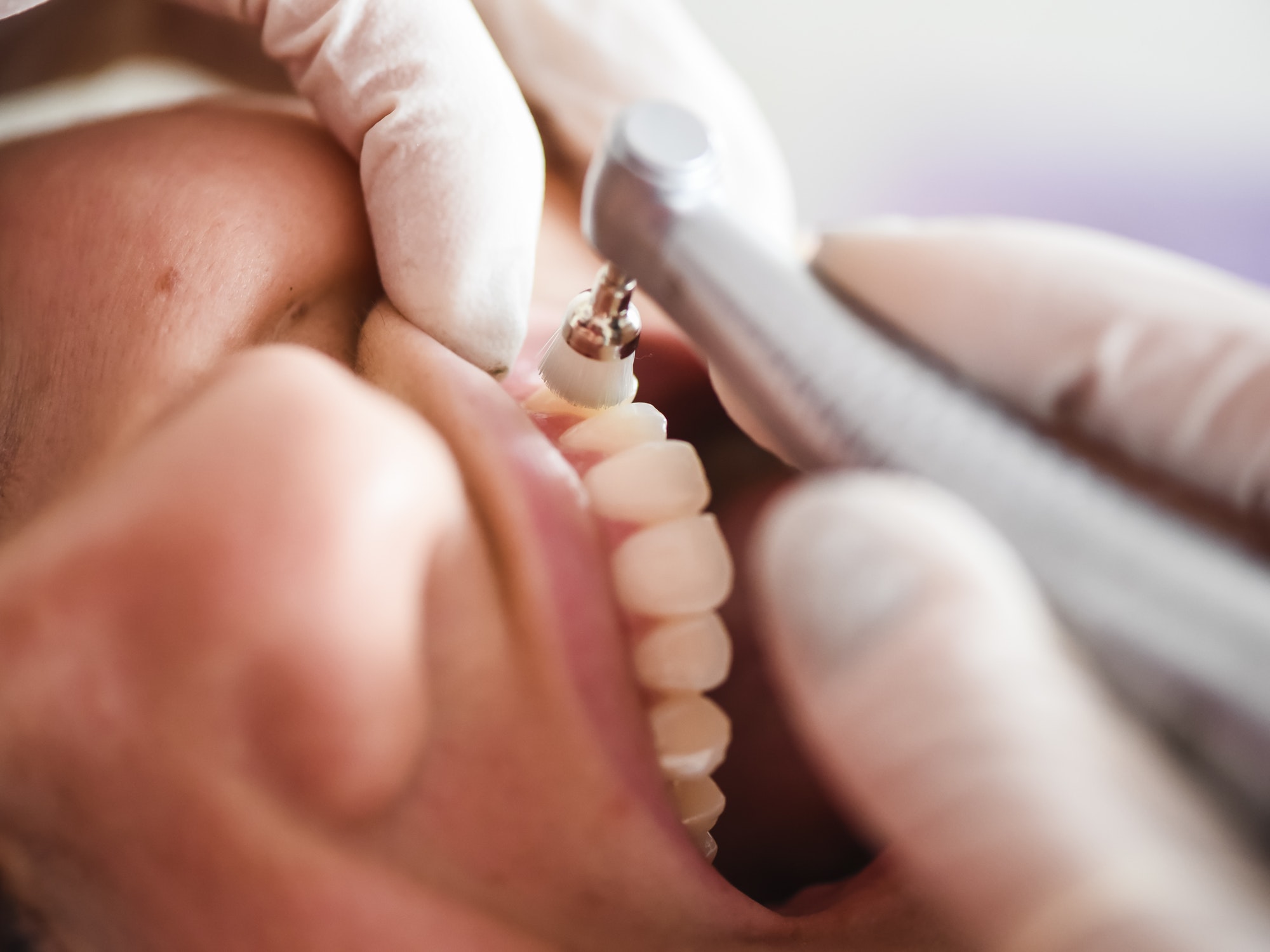 Dental Check